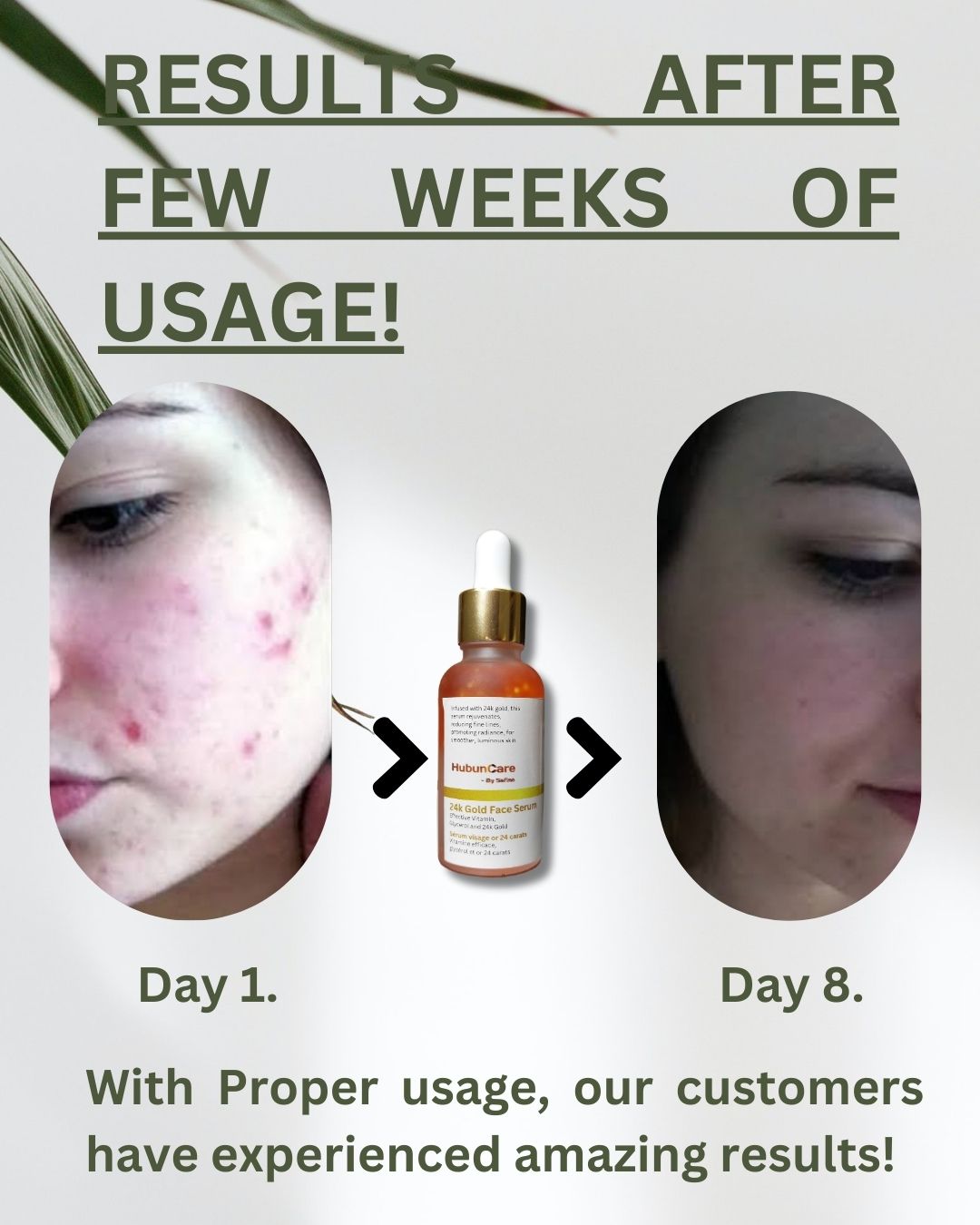 24k Gold face serum for acne and dark spots